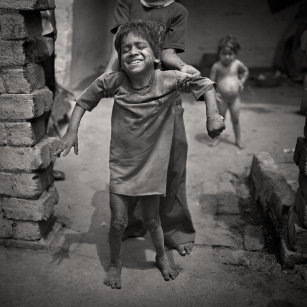 "Bhopal: Cause2Effect": Suraj Rai