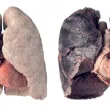 Poumon: sain contre fumeur