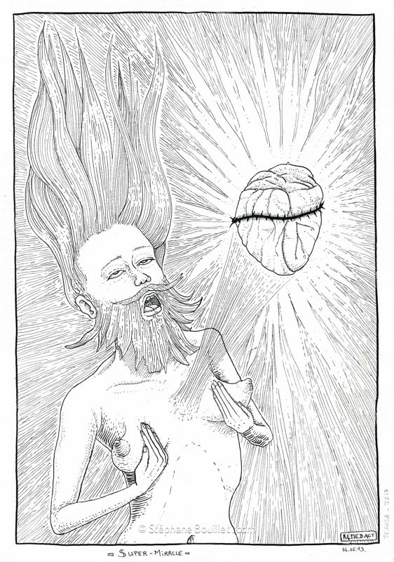 J217 /// Super-miracle