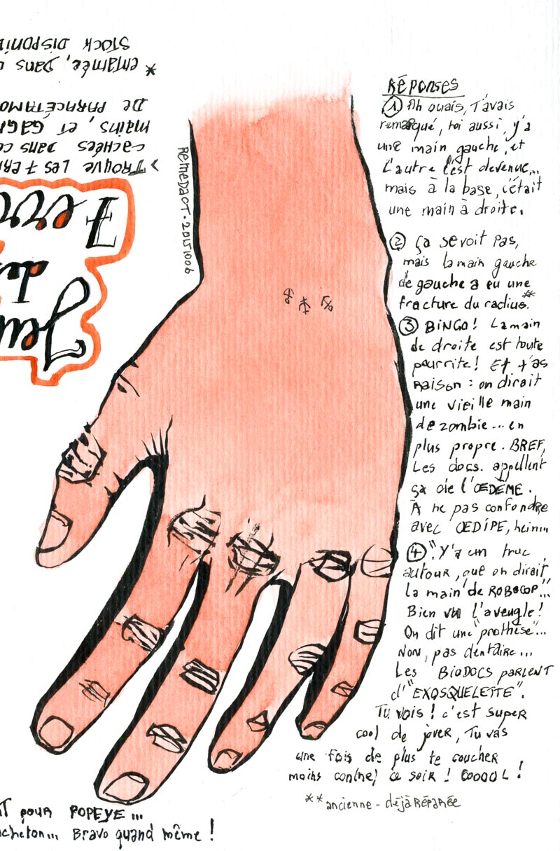 Jeu des 7 erreurs sur deux mains : les réponses