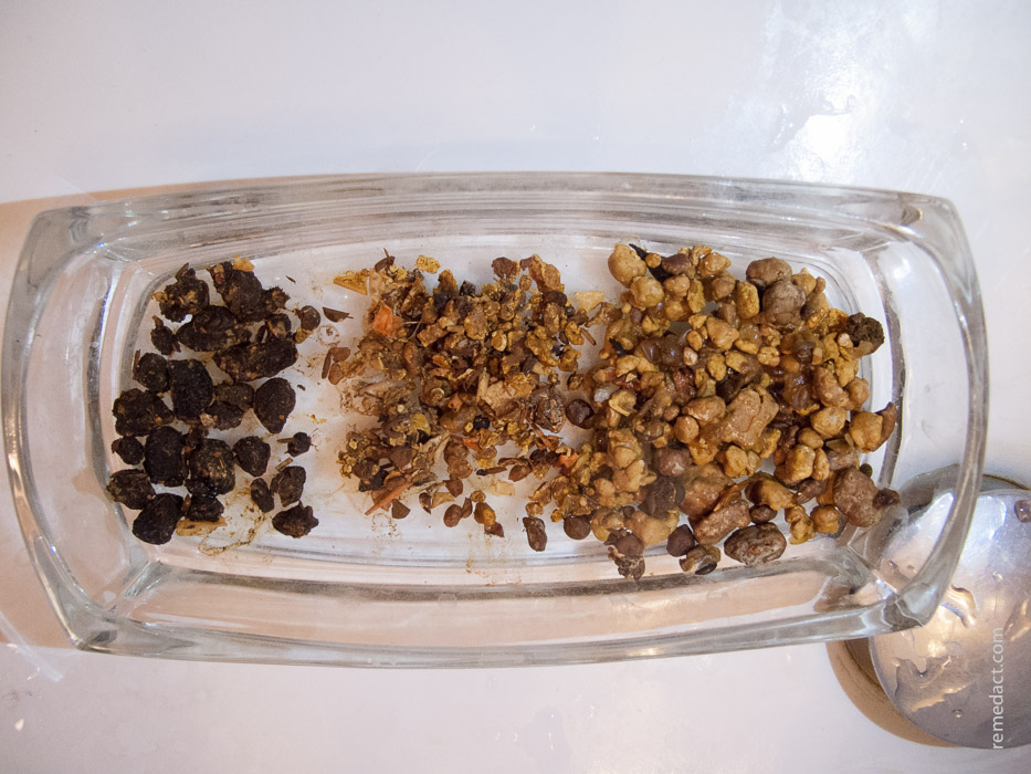 Nettoyage du foie et vésicule biliaire : cure d&rsquo;Andreas Moritz